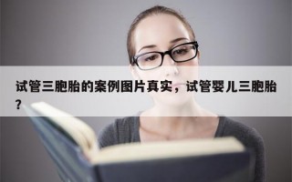 试管三胞胎的案例图片真实，试管婴儿三胞胎？